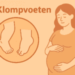 klompvoeten - Verloskundige Kampen PuurBegin