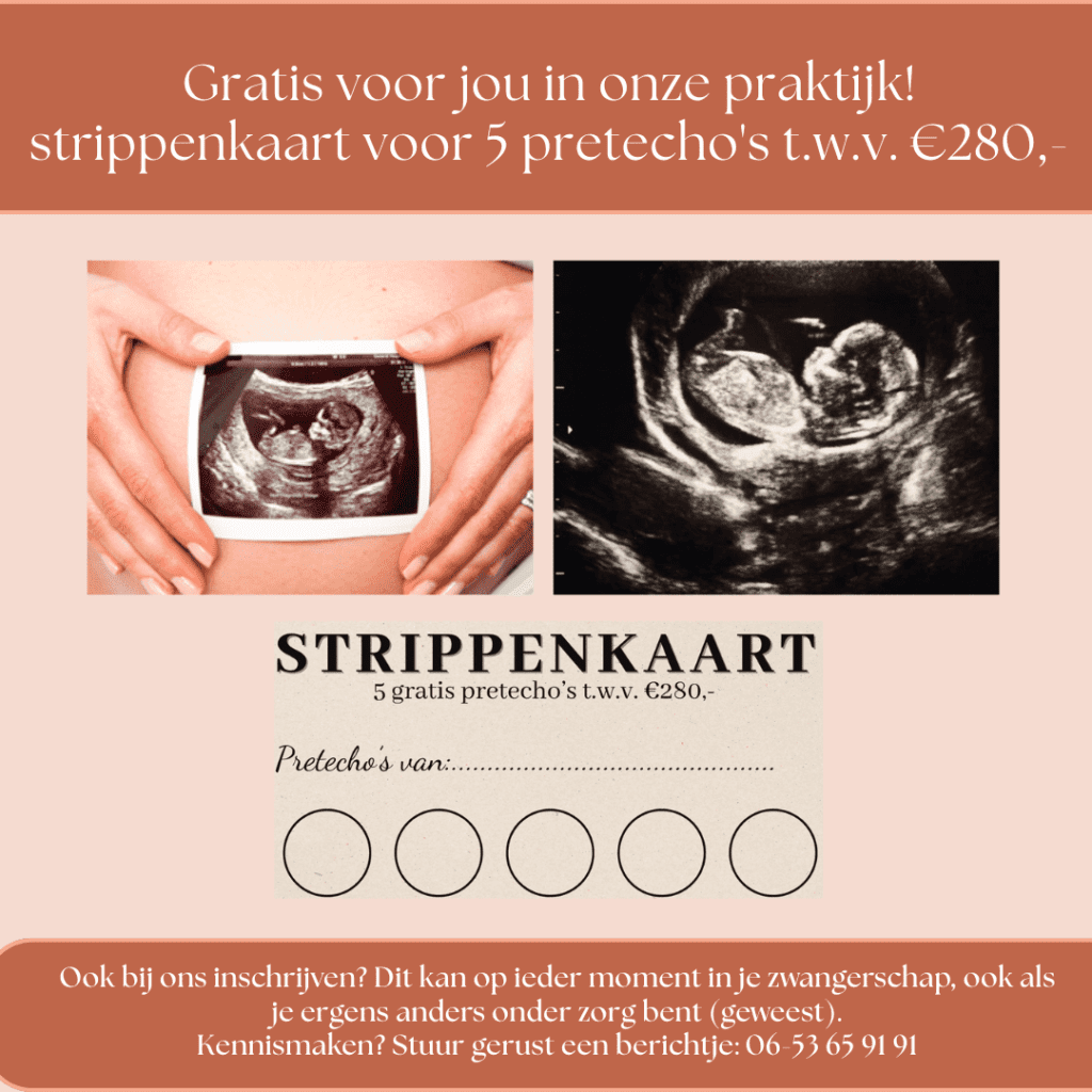 Echo strippenkaart Verloskundigen PuurBegin